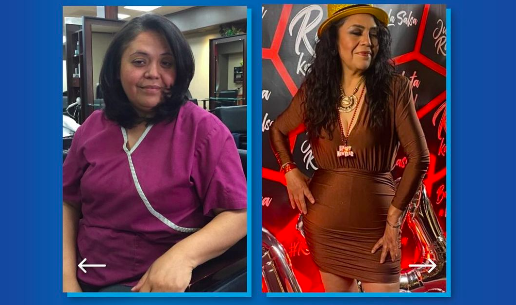 best kept secret in louisiana: gastric sleeve surgery